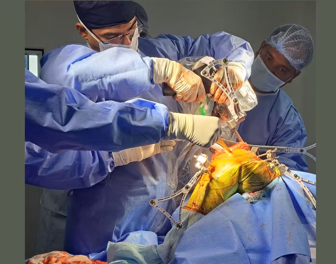 Robotic Revision Knee Replacement